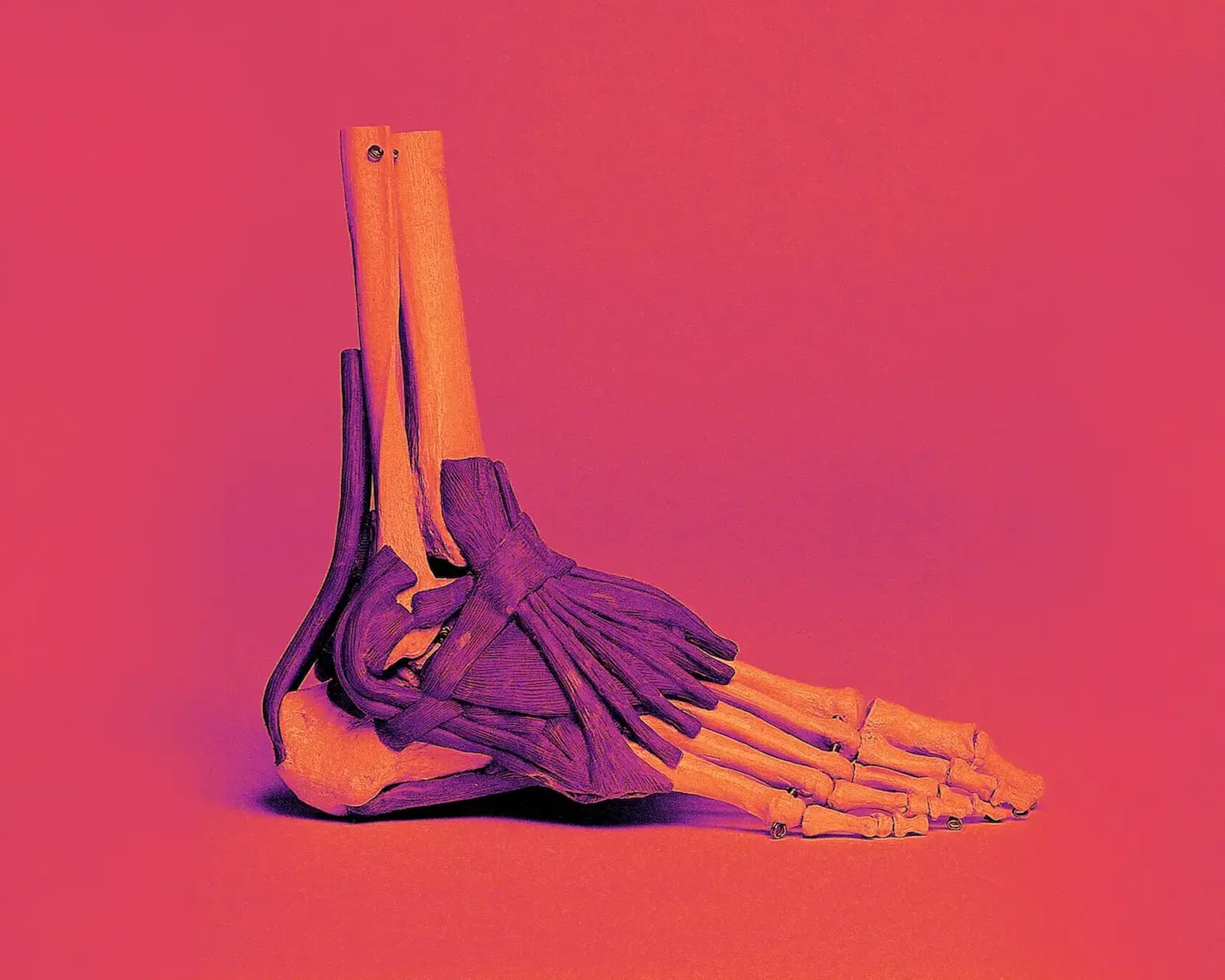 Cover Image for Preventing Achilles Pain When Running: 1 Month Post Injury Update